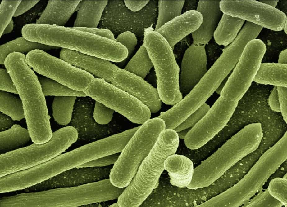 What causes bowel problems in elderly people